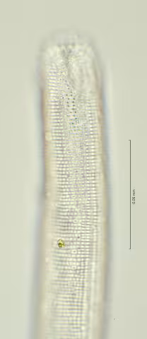 head region w amphid 100x
