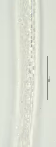 lateral field mid body 100x