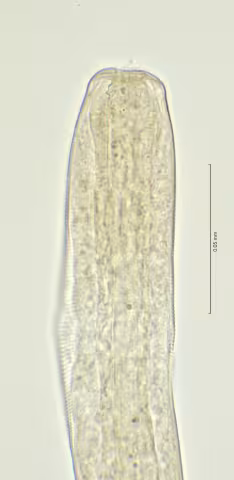 head region w dorsal tooth 100x