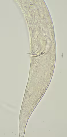 tail region 100x stack