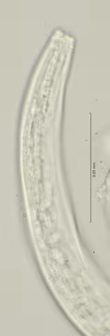 head region w amphid 100x