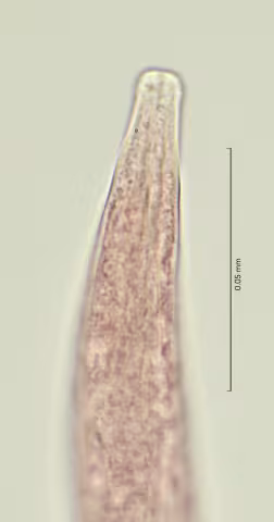 head region w cephalic seta 100x