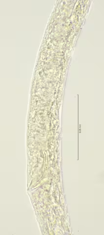 cloaca region 100x stack