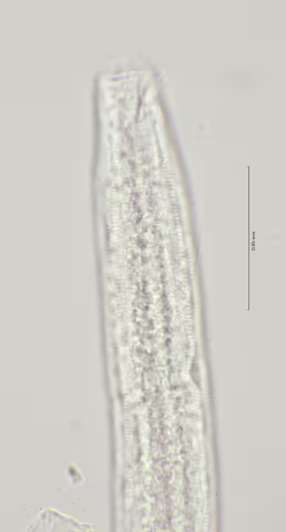 head region w amphid 100x