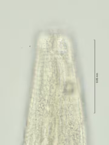 head region w amphid and cephalic setae 100x