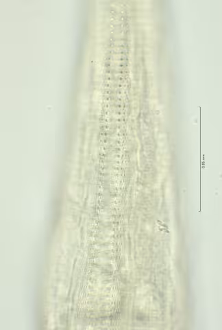lateral field lower oesophagus region 100x