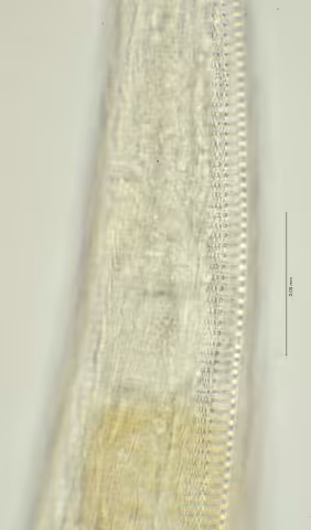 lateral field at oesophagus end 100x