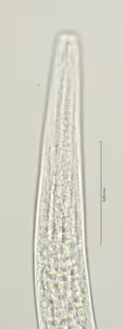 head region w cervical setae 100x