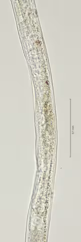vulva region 40x