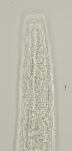 head region w amphid 100x