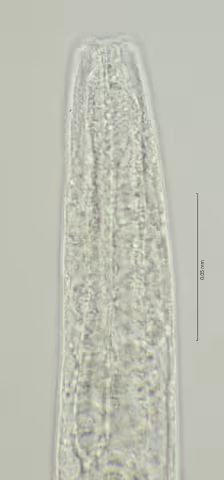 head region w cephalic setae 100x