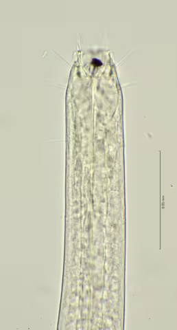 head region 100x